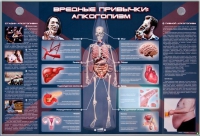 Электрифицированный стенд "Вредные привычки: алкоголизм" - «globural.ru» - Жигулёвск